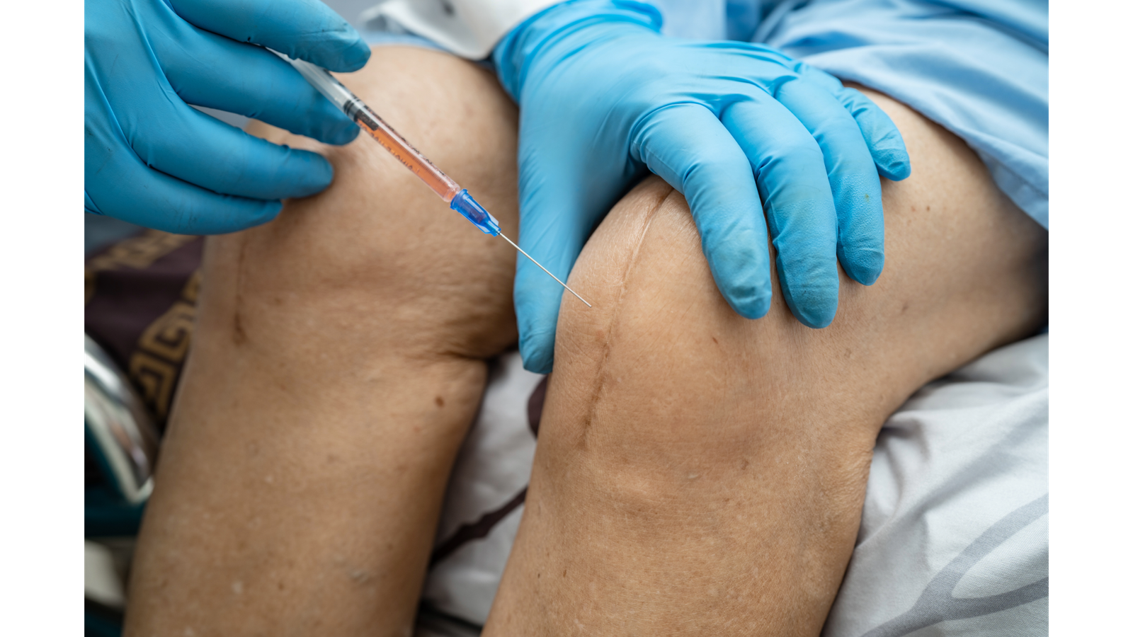 Regenerative Medicine: A Cutting-Edge Solution for Chronic Pain Relief